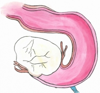 Třetina žen s rakovinou vaječníků nedostane šanci ochránit své blízké